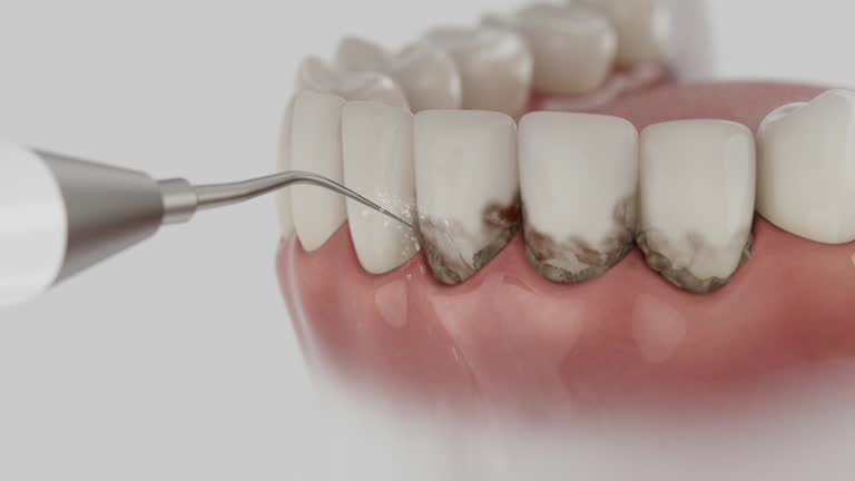 Trusted Dental Implants service in Punta Gorda, FL - Dentist Open Now